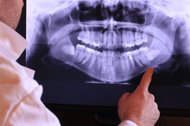 Best Weekend Emergency Dentist in Rosemont, IL